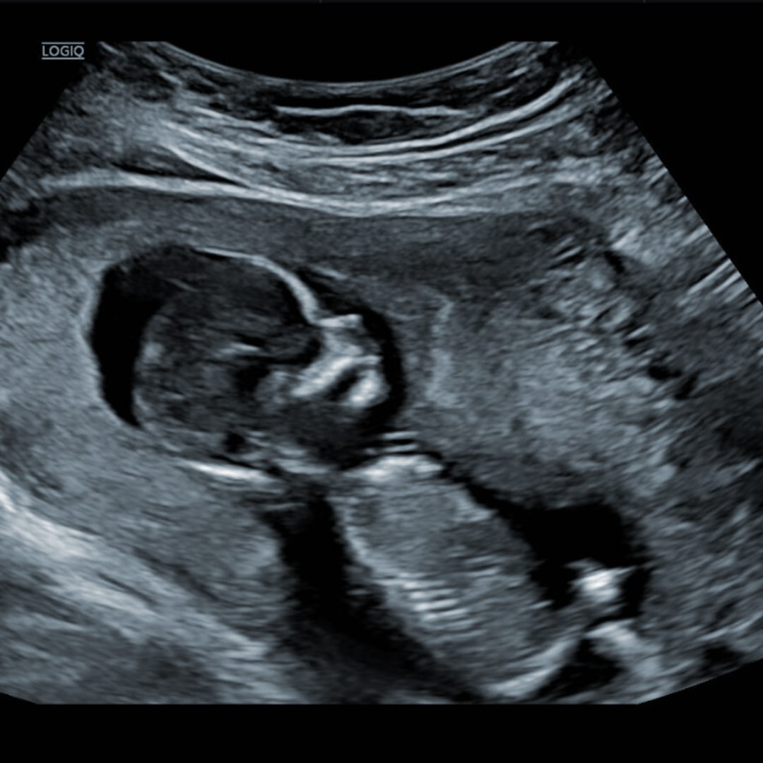 Photo shared by Andi for their Babylist baby registry.