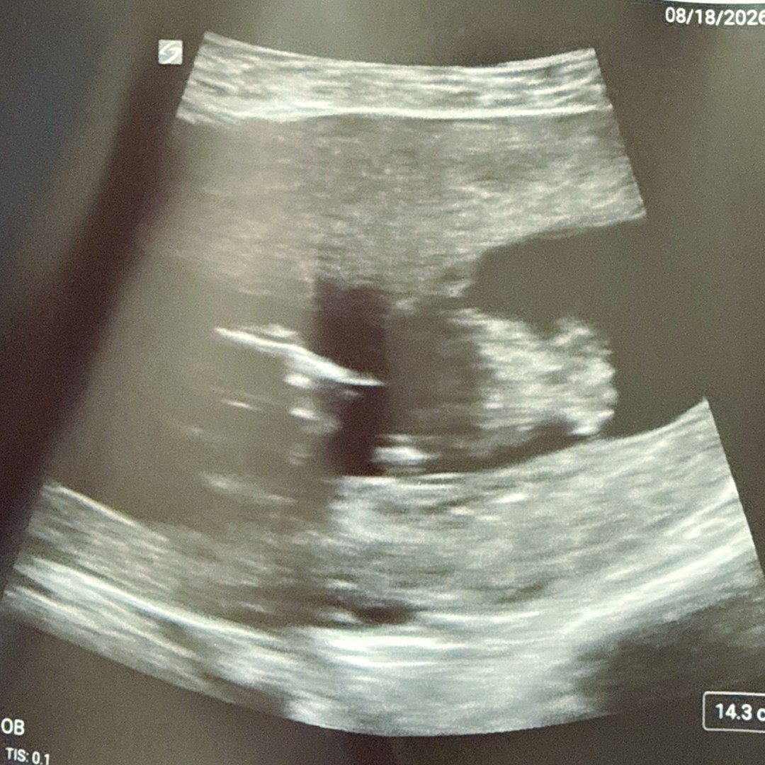 Photo shared by Kathryn for their Babylist baby registry.