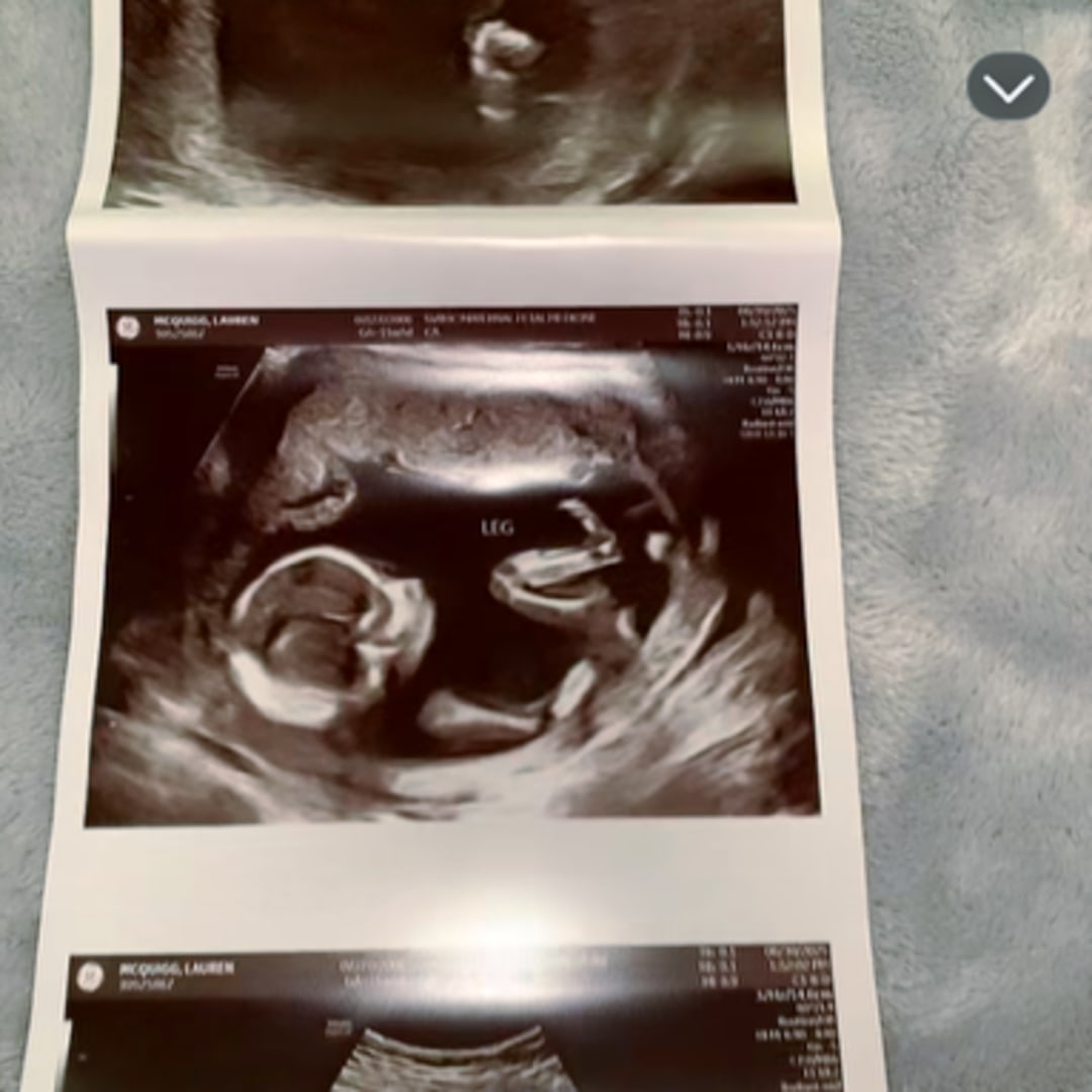 Photo shared by Lauren for their Babylist baby registry.