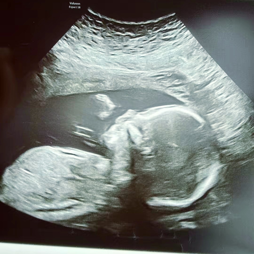 Photo shared by Shelby for their Babylist baby registry.