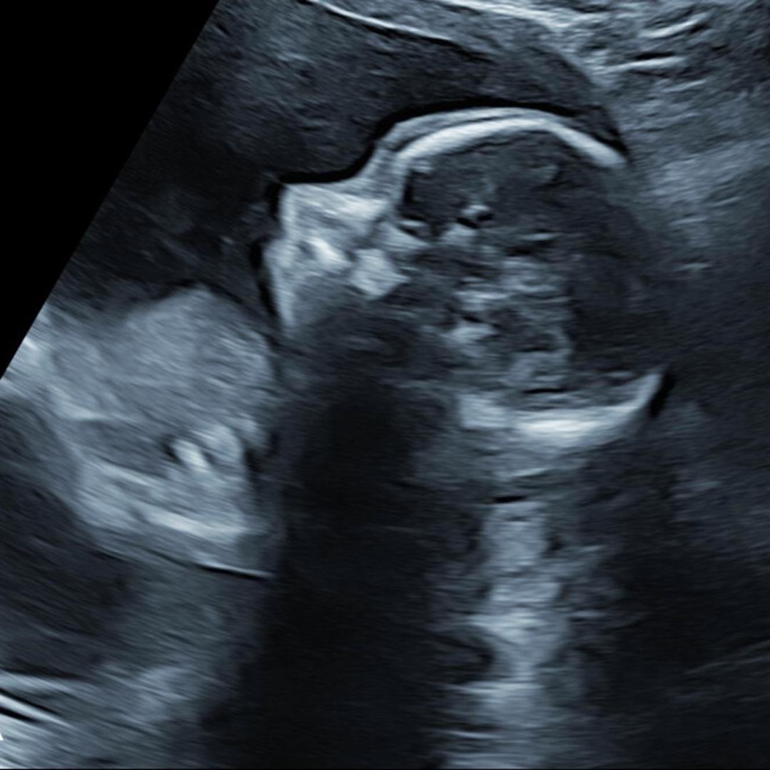 Photo shared by Alysha for their Babylist baby registry.