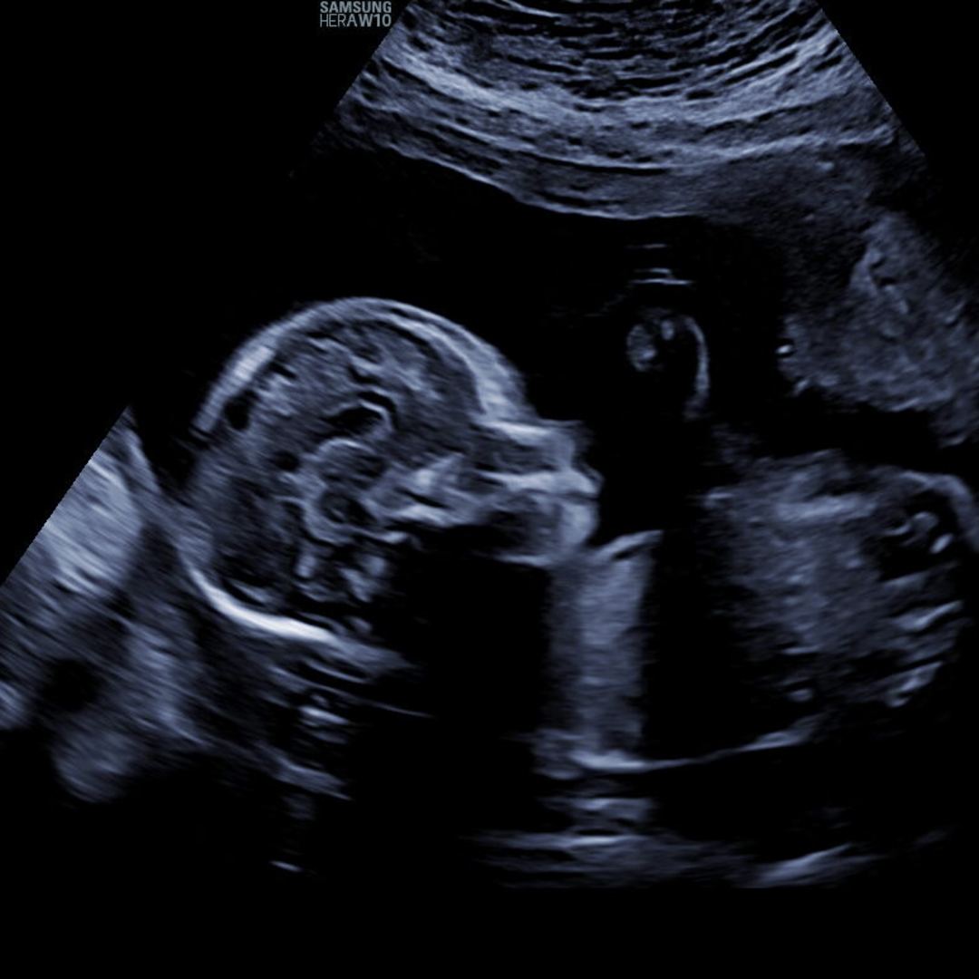 Photo shared by Mayla for their Babylist baby registry.