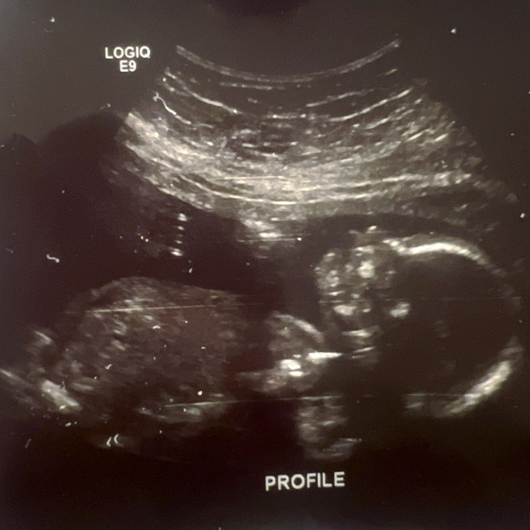 Photo shared by Dhalia for their Babylist baby registry.