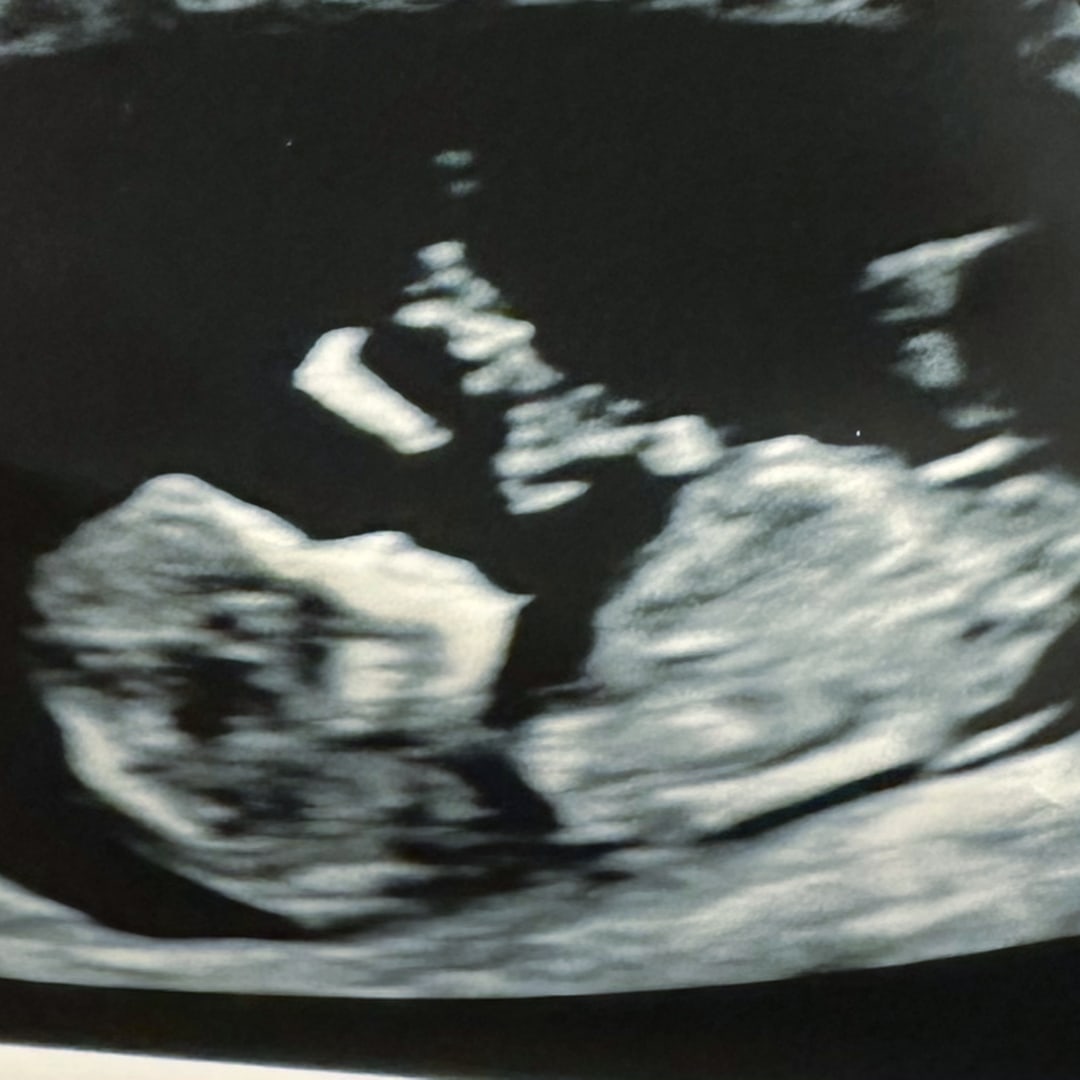 Photo shared by Deyana for their Babylist baby registry.