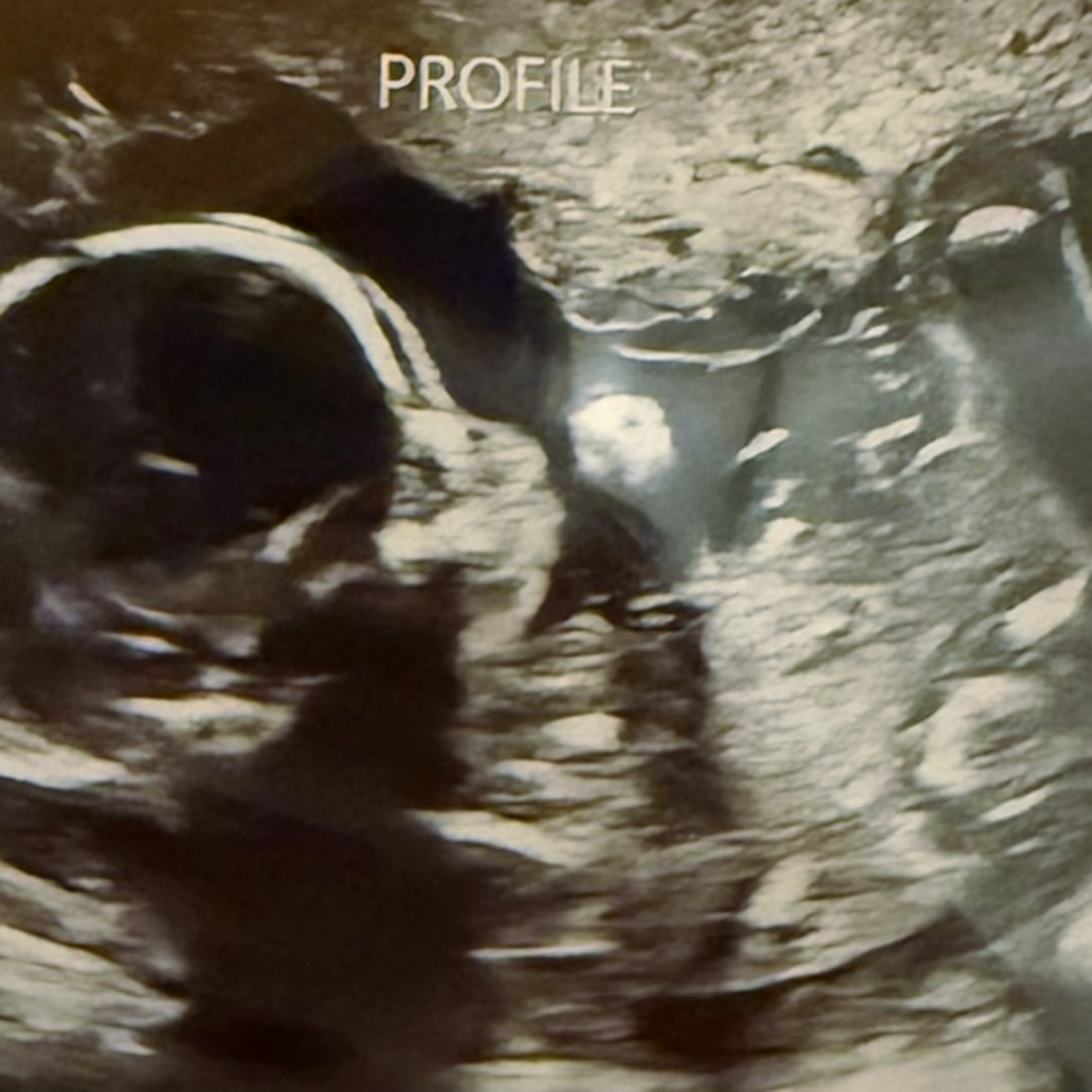 Photo shared by Julia for their Babylist baby registry.