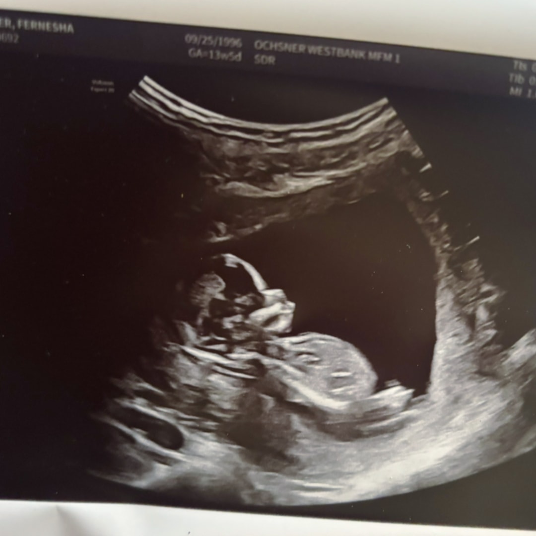 Photo shared by Fernesha for their Babylist baby registry.