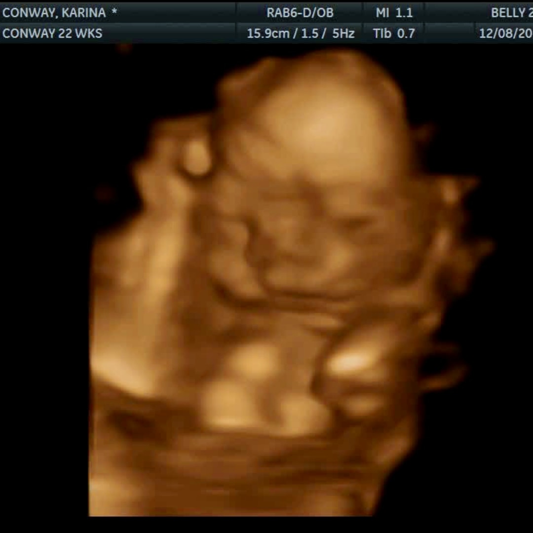 Photo shared by Ryan for their Babylist baby registry.