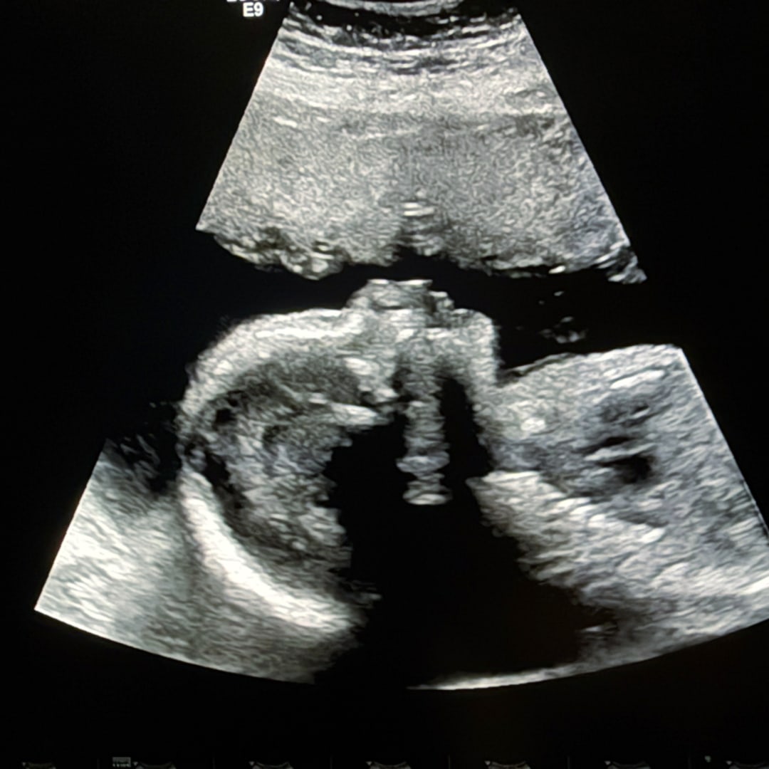 Photo shared by Danielle for their Babylist baby registry.