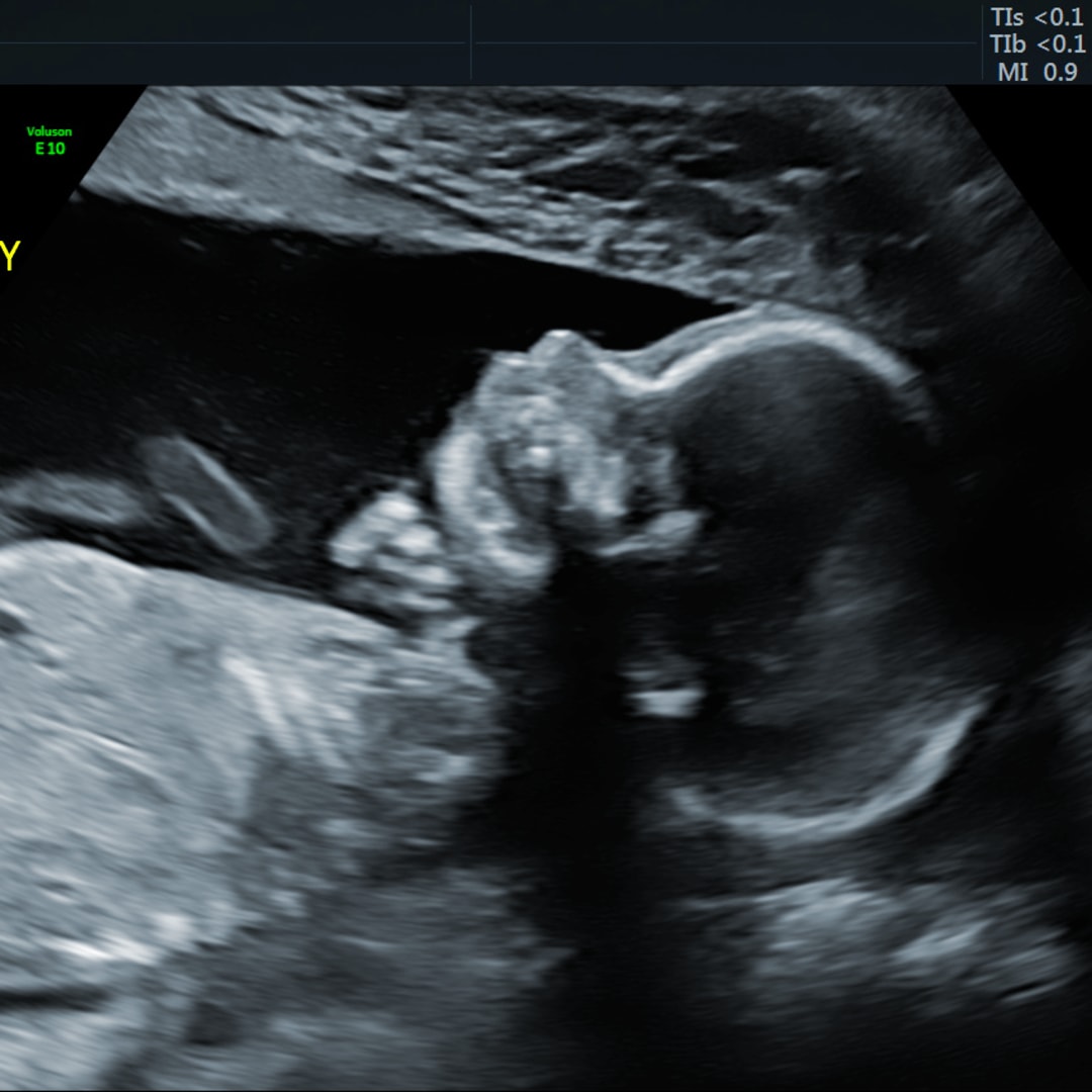 Photo shared by Elizabeth for their Babylist baby registry.