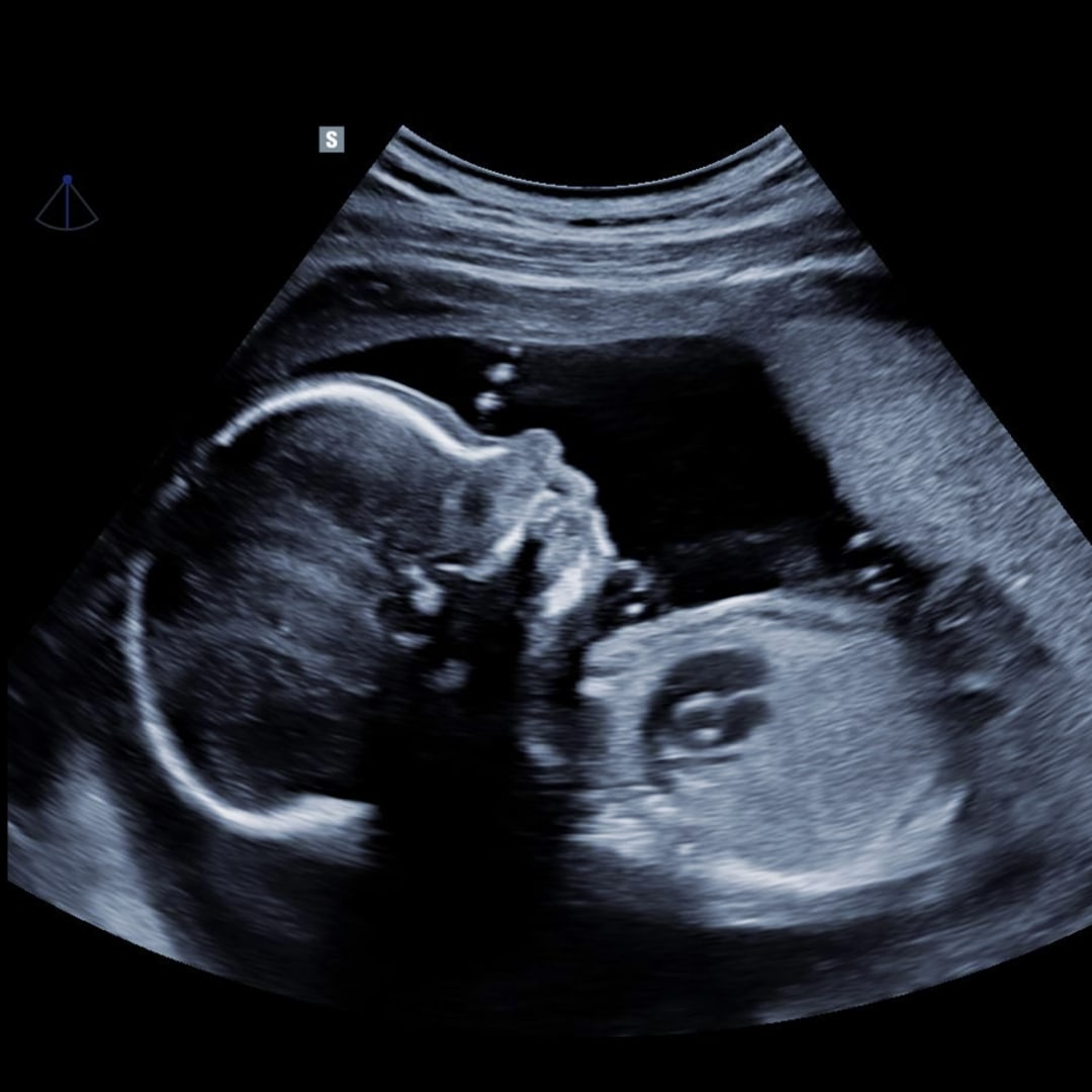 Photo shared by Stef for their Babylist baby registry.