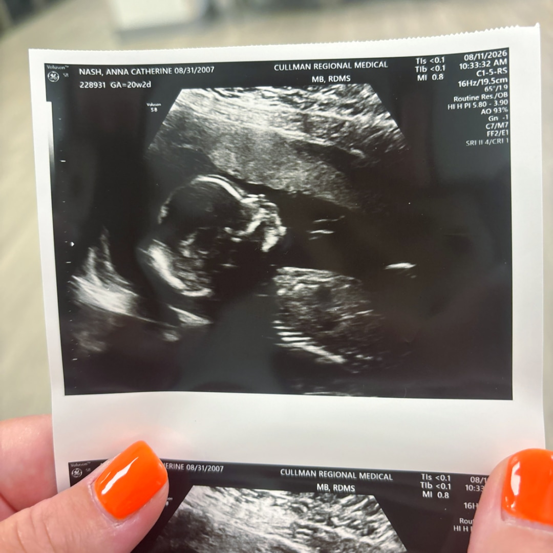 Photo shared by Anna for their Babylist baby registry.
