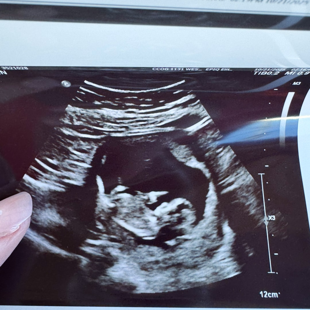 Photo shared by Taylor for their Babylist baby registry.