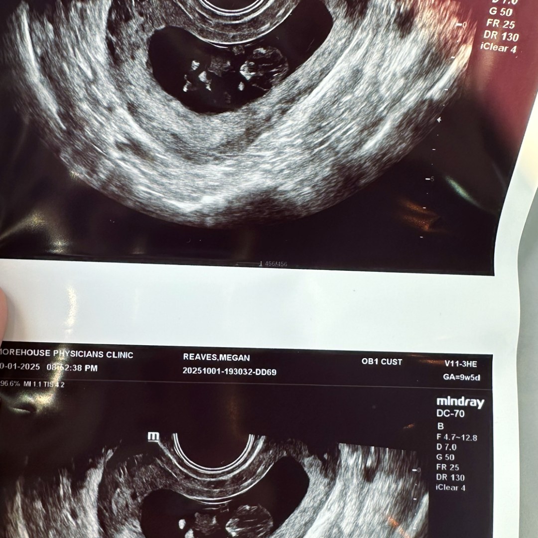 Photo shared by Megan for their Babylist baby registry.