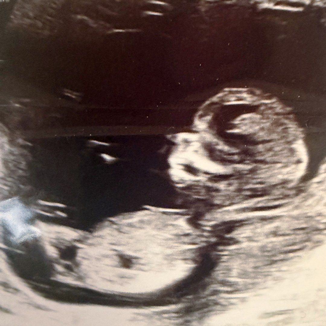 Photo shared by Arianna for their Babylist baby registry.