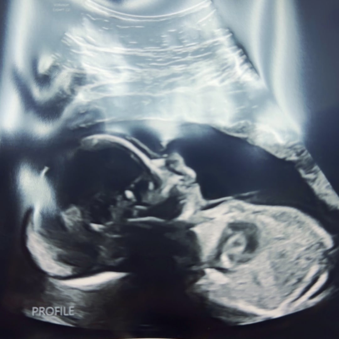 Photo shared by Annaliese for their Babylist baby registry.