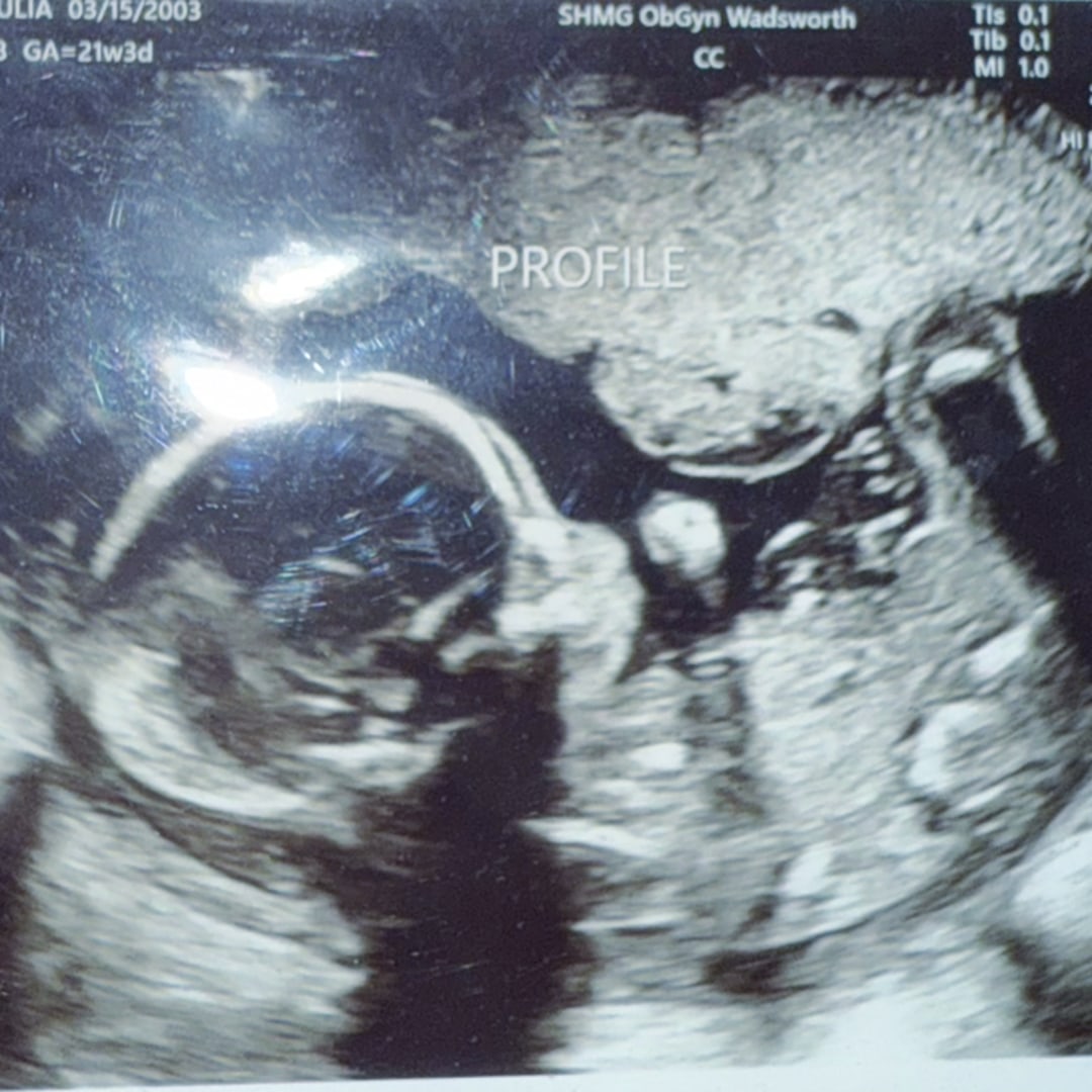 Photo shared by Julia for their Babylist baby registry.