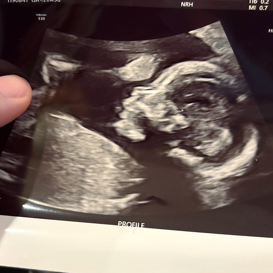 Photo shared by Leah for their Babylist baby registry.