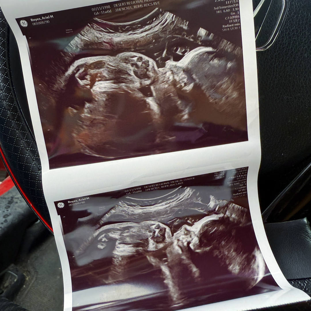 Photo shared by Ariel for their Babylist baby registry.