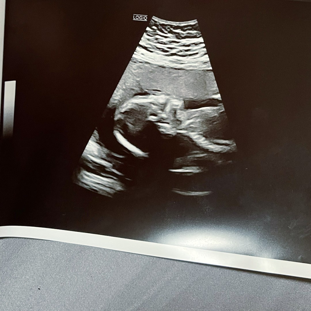 Photo shared by Delanie for their Babylist baby registry.
