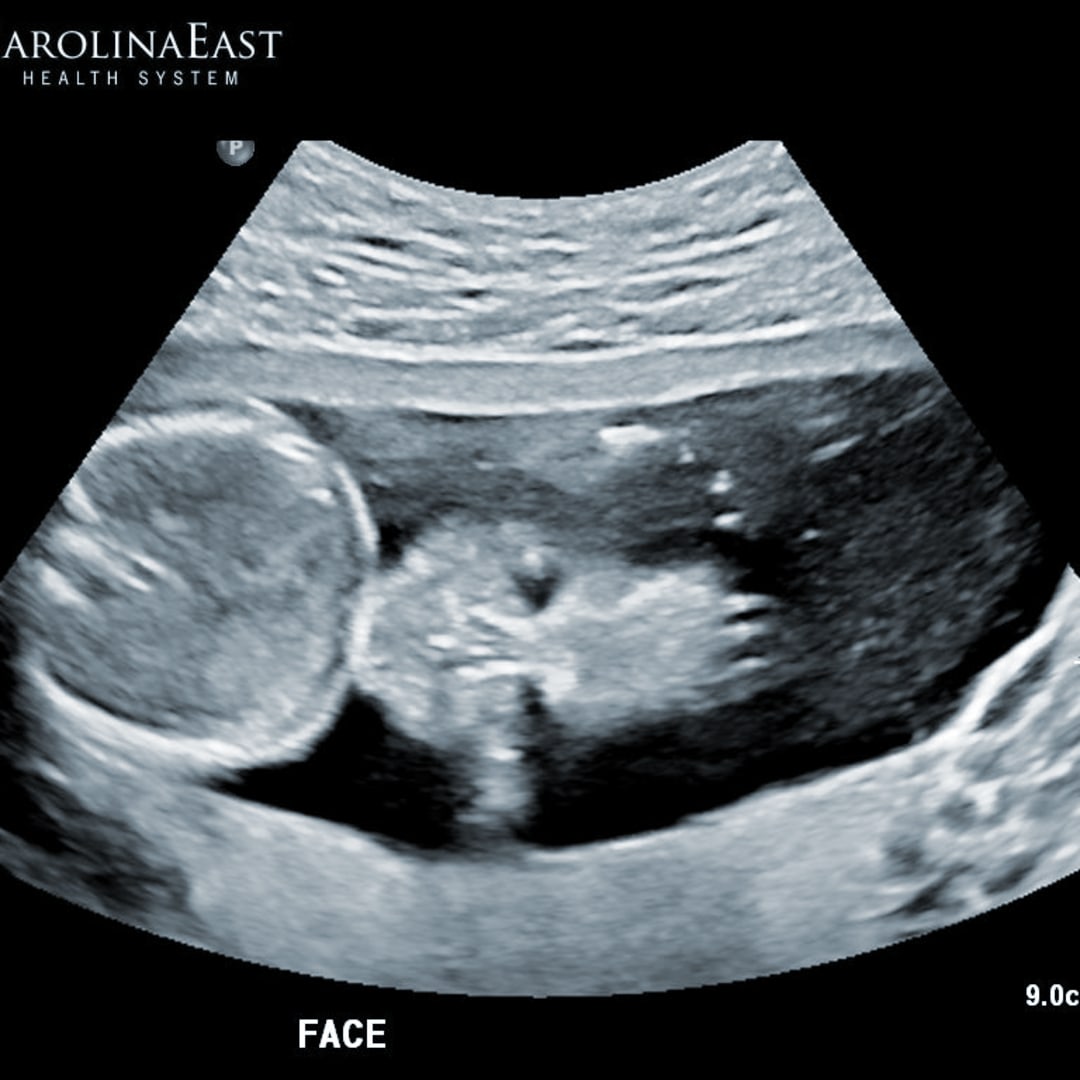 Photo shared by Tiffany for their Babylist baby registry.