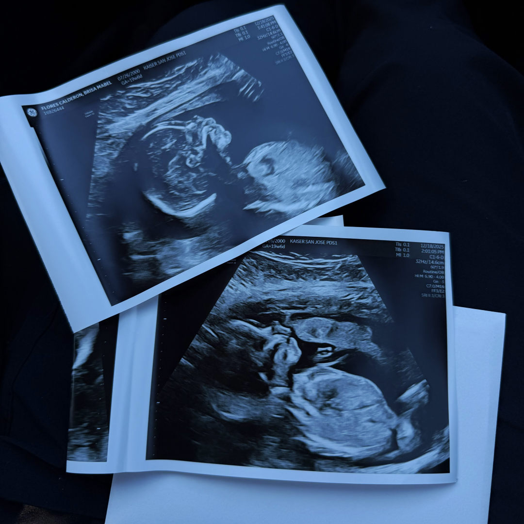 Photo shared by Brisa for their Babylist baby registry.