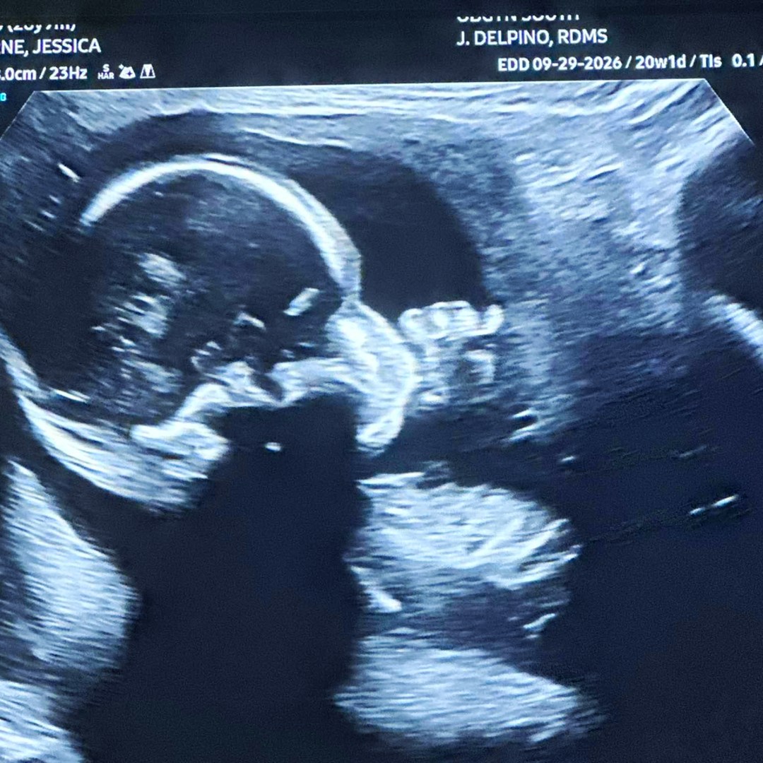 Photo shared by Jess for their Babylist baby registry.