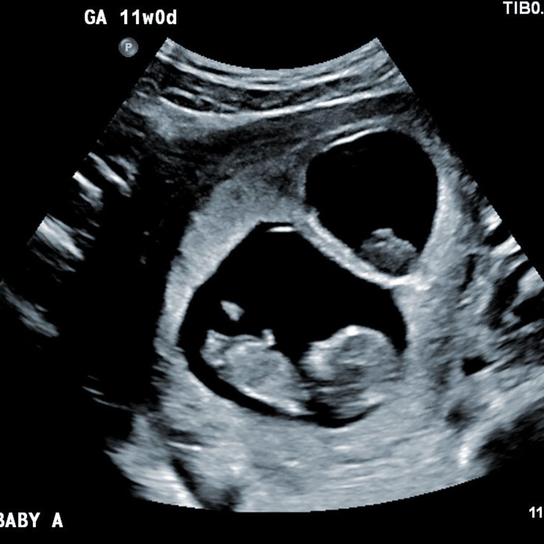 Photo shared by Brooklyn for their Babylist baby registry.