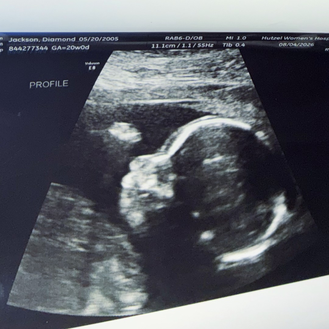 Photo shared by Diamond for their Babylist baby registry.