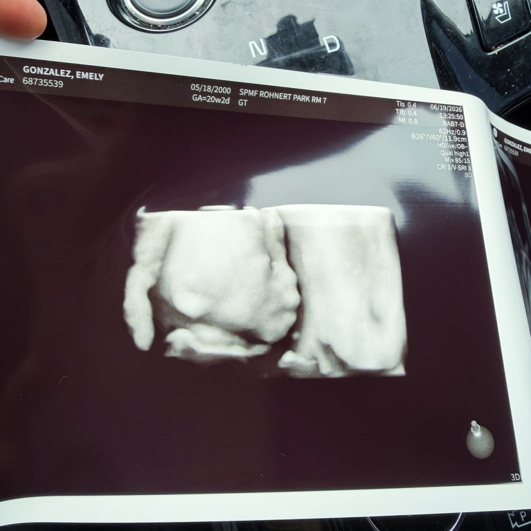 Photo shared by Emely for their Babylist baby registry.