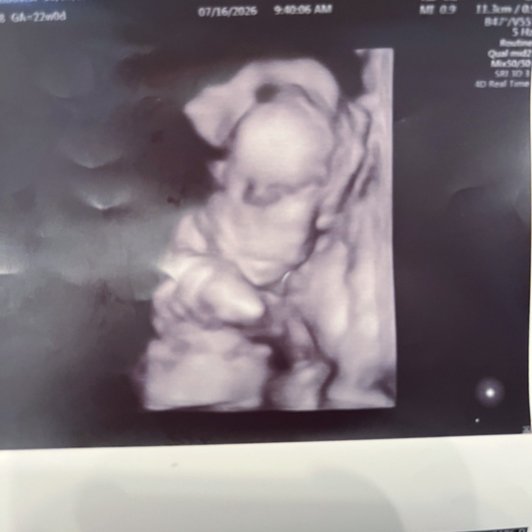 Photo shared by Bianca for their Babylist baby registry.