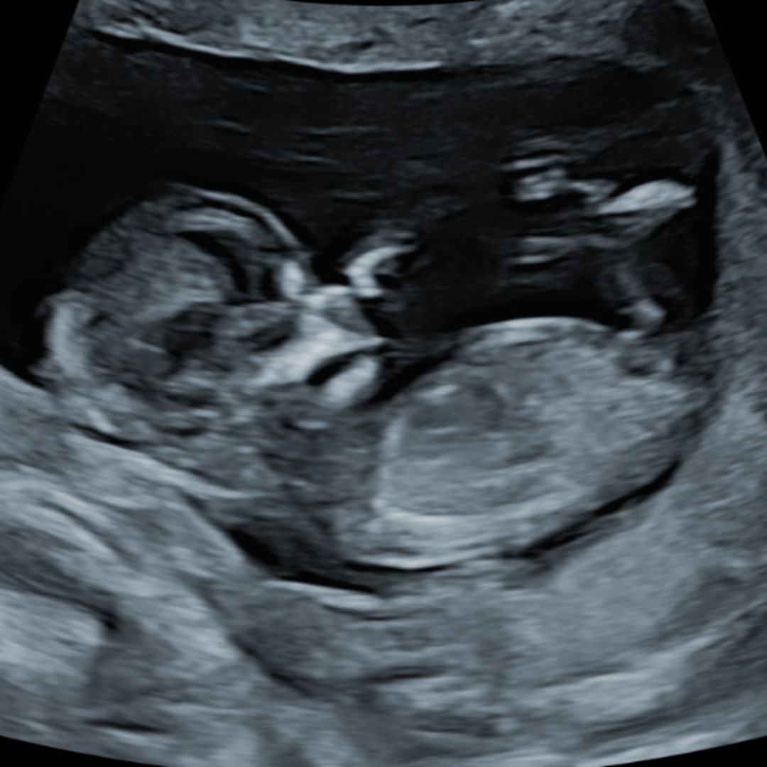 Photo shared by Stephanie for their Babylist baby registry.