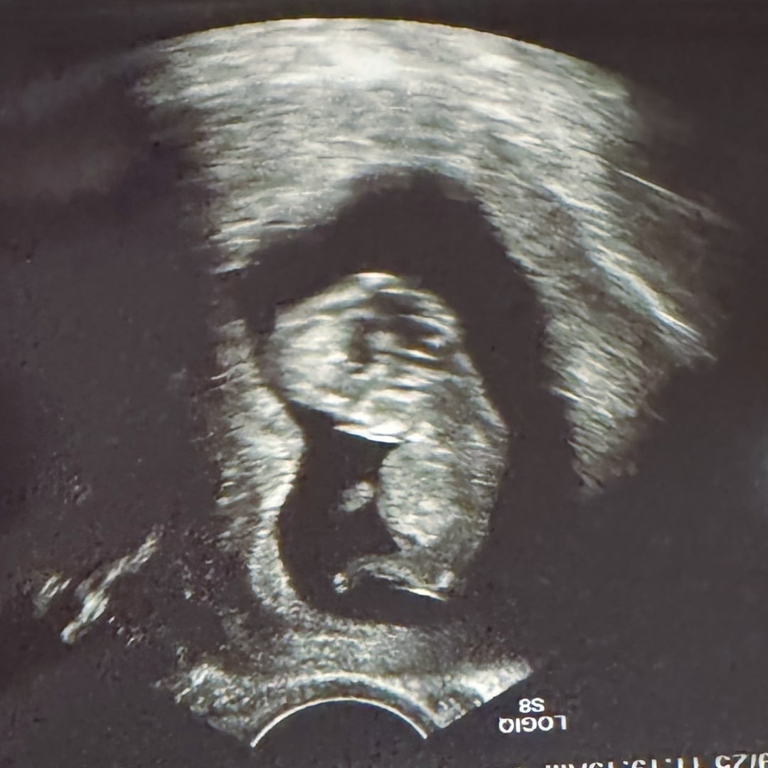 Photo shared by Janelle for their Babylist baby registry.