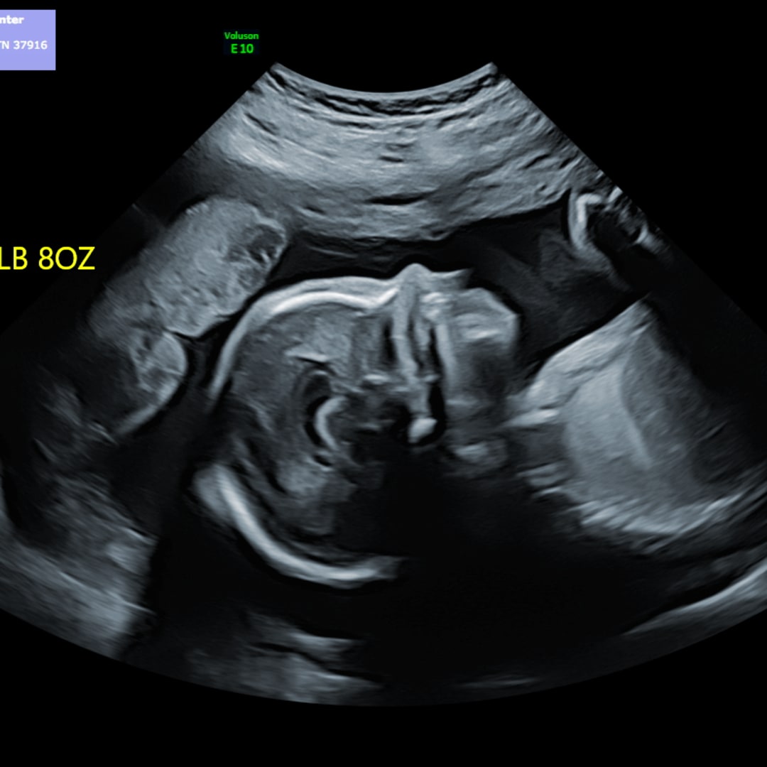 Photo shared by Haily for their Babylist baby registry.