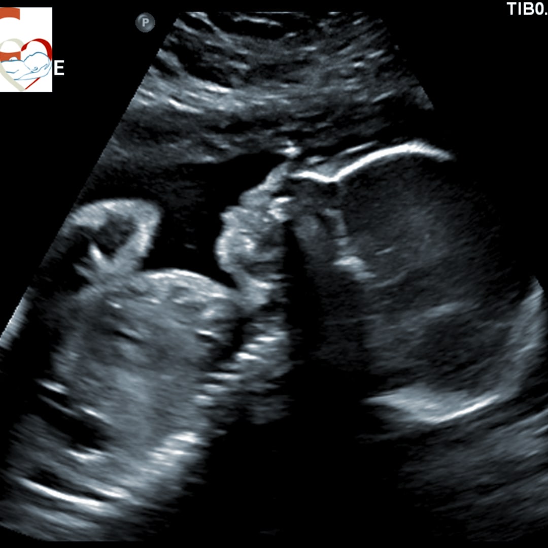 Photo shared by Kaylee for their Babylist baby registry.