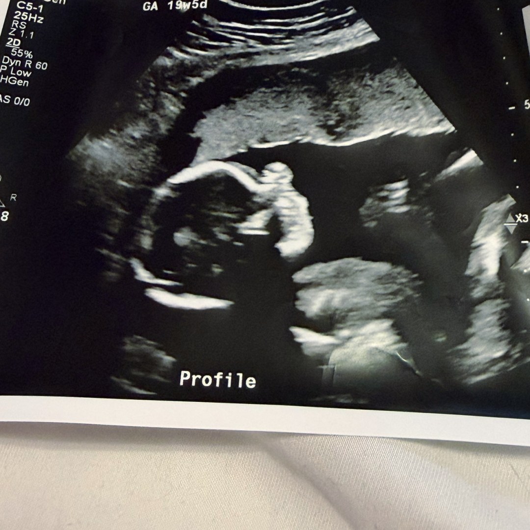 Photo shared by Juan for their Babylist baby registry.