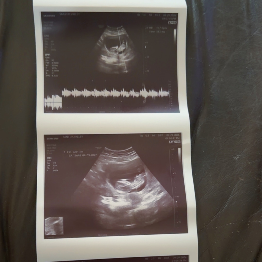 Photo shared by Angel for their Babylist baby registry.
