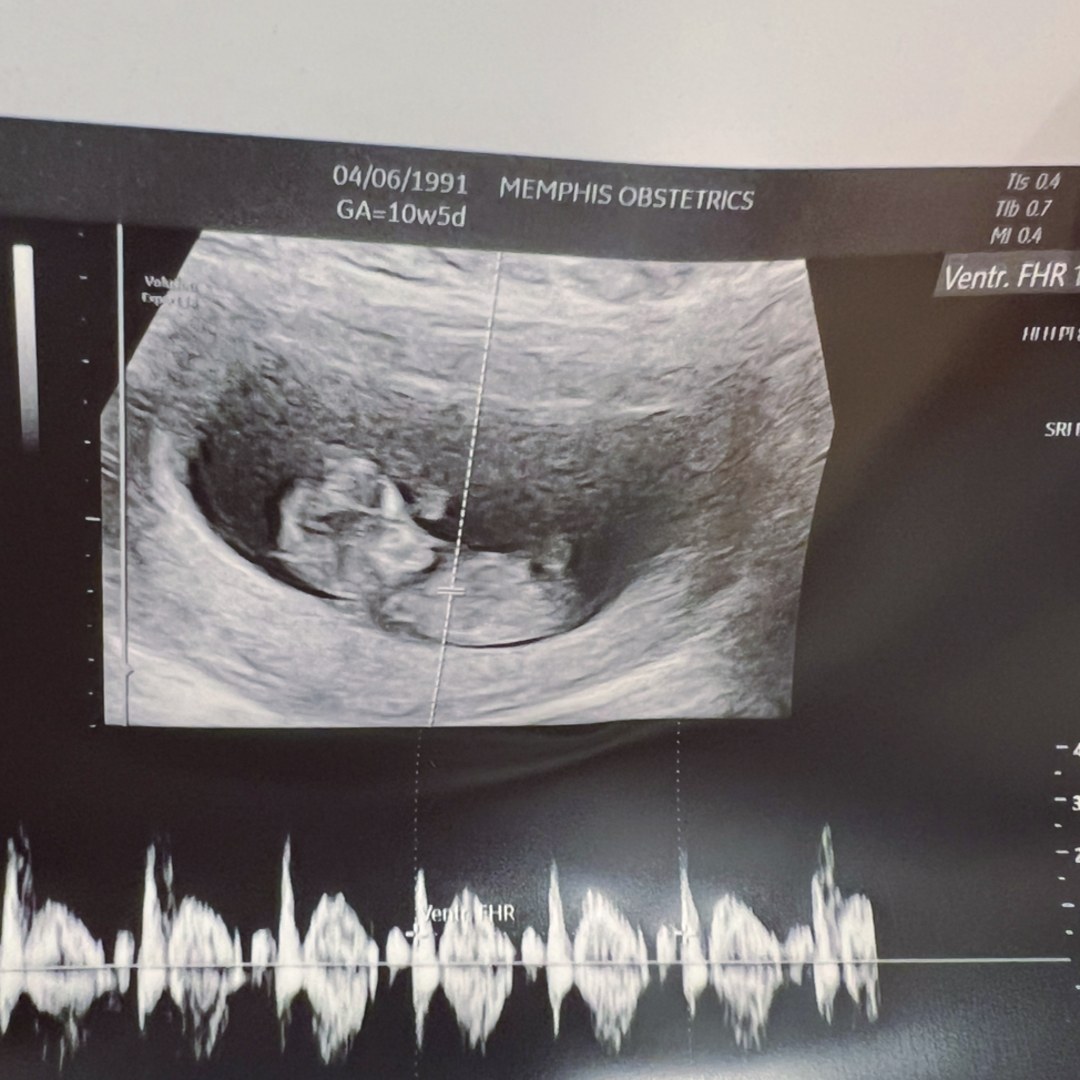 Photo shared by Anna for their Babylist baby registry.