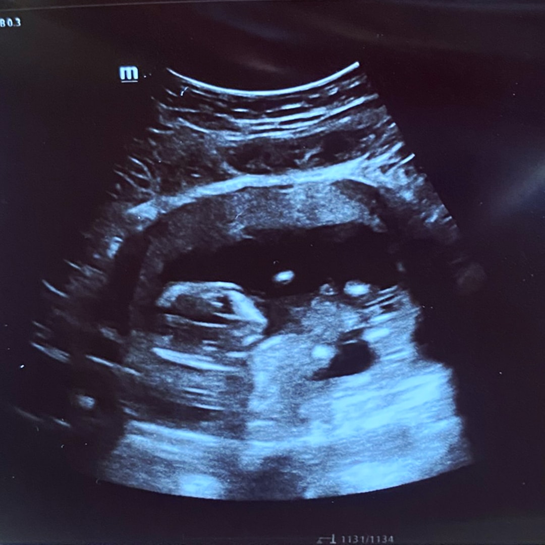 Photo shared by Lizzy for their Babylist baby registry.