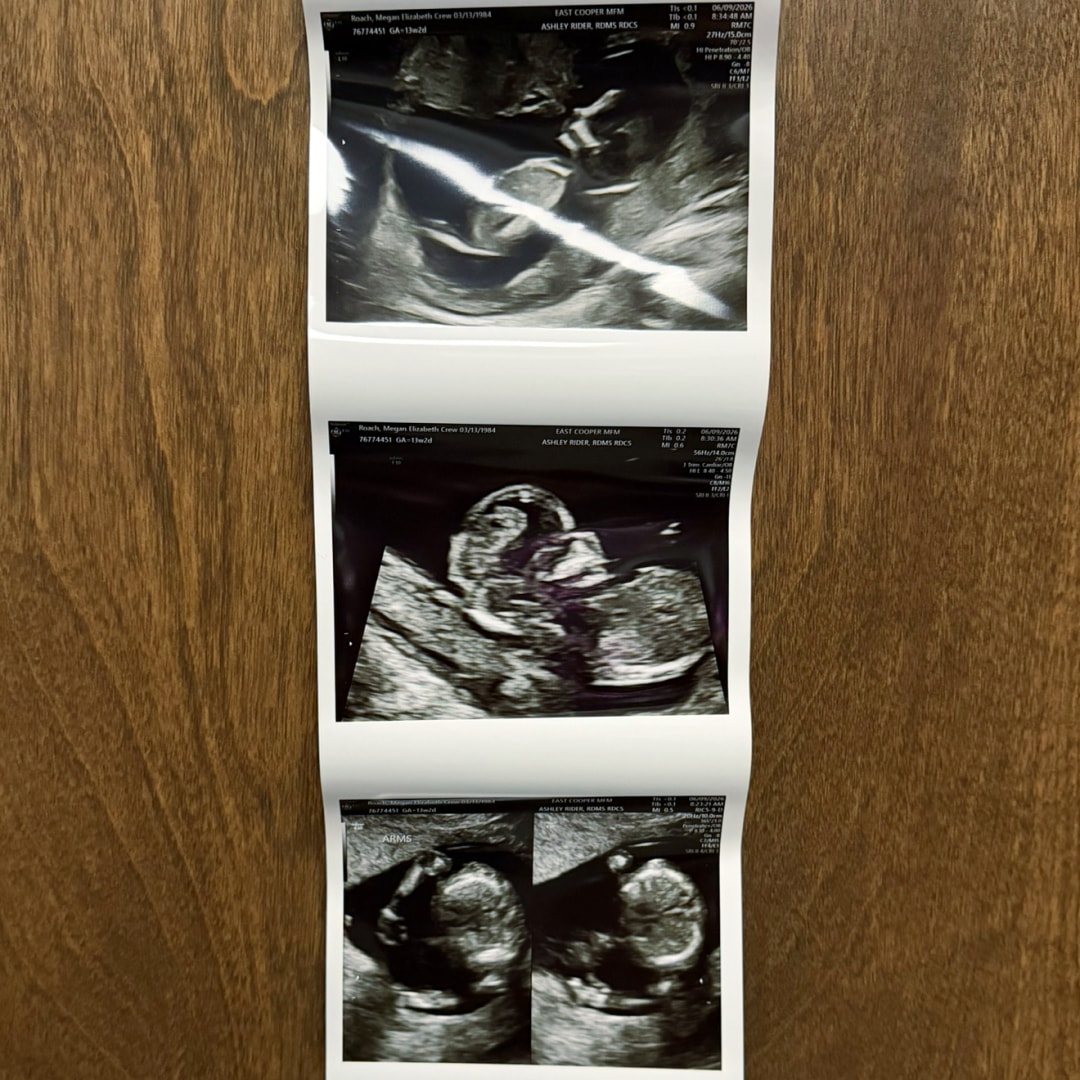 Photo shared by Megan for their Babylist baby registry.