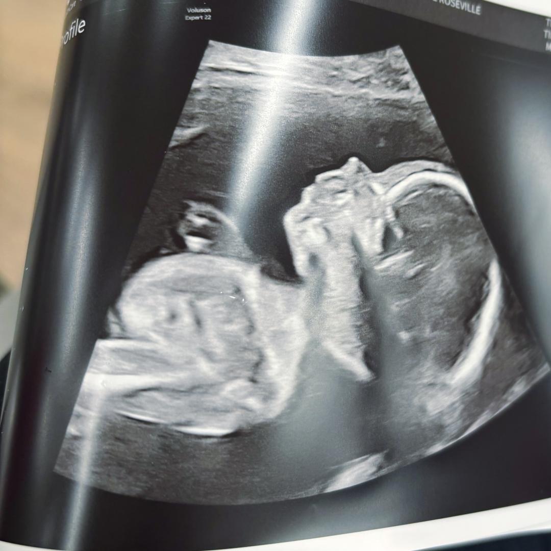 Photo shared by Cassandra for their Babylist baby registry.