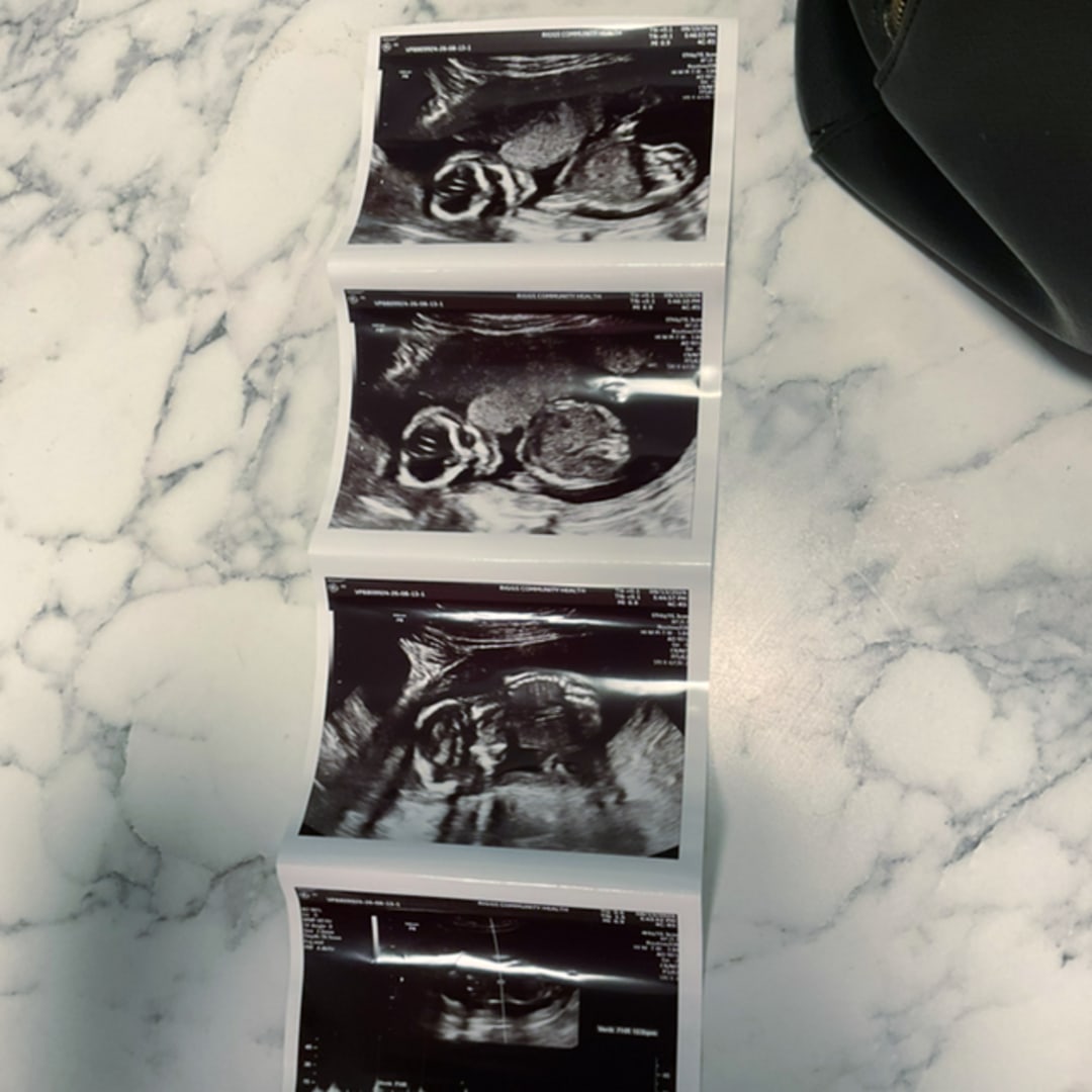 Photo shared by Haleah for their Babylist baby registry.