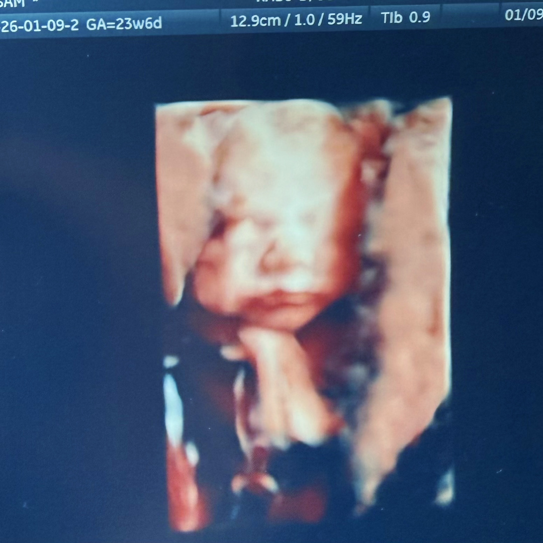 Photo shared by Sam for their Babylist baby registry.