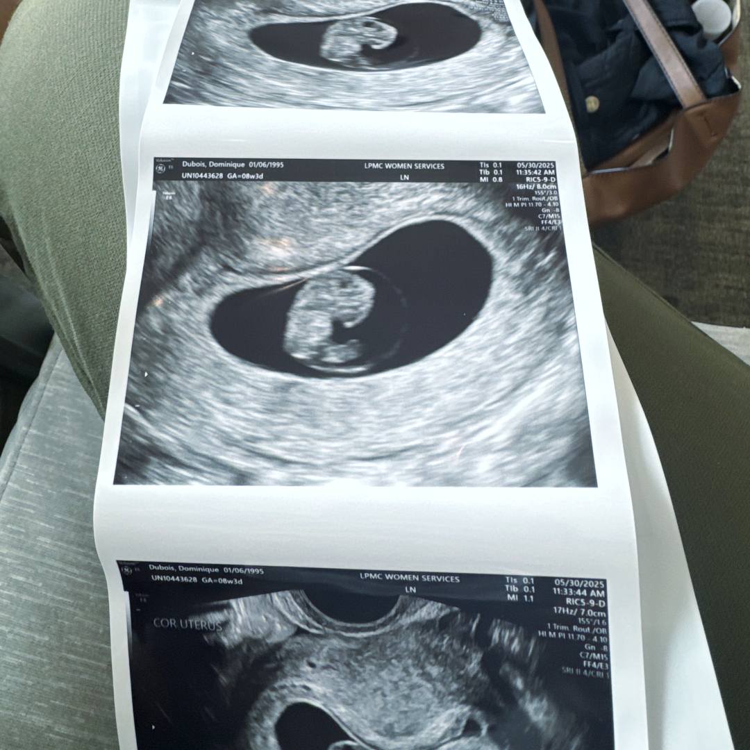 Photo shared by Mika for their Babylist baby registry.