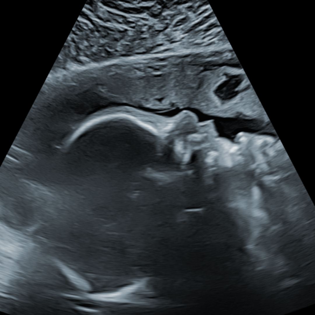Photo shared by Courtney for their Babylist baby registry.