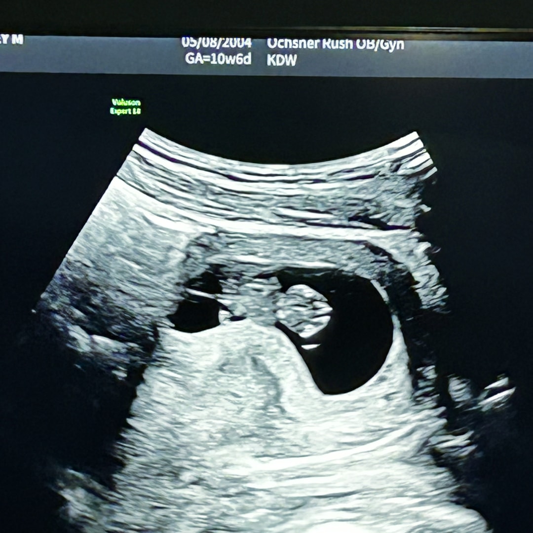 Photo shared by Harley for their Babylist baby registry.