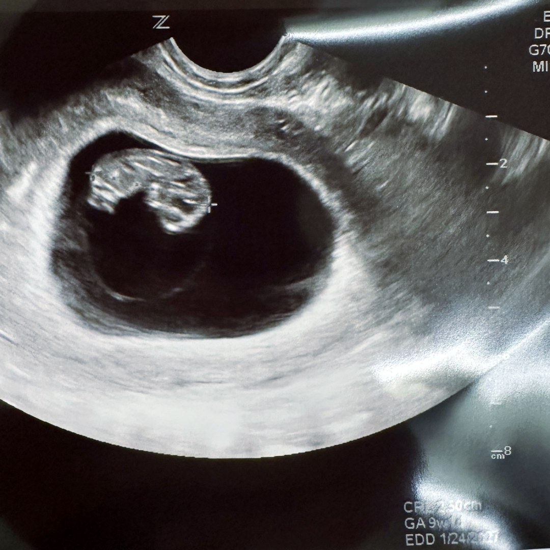 Photo shared by Spencer for their Babylist baby registry.