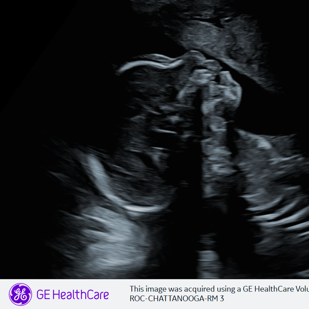 Photo shared by Carly for their Babylist baby registry.