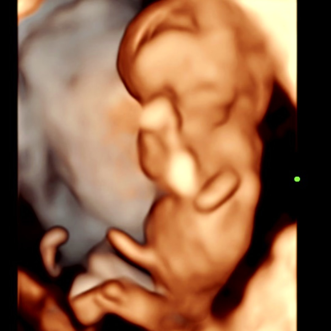 Photo shared by Allison for their Babylist baby registry.