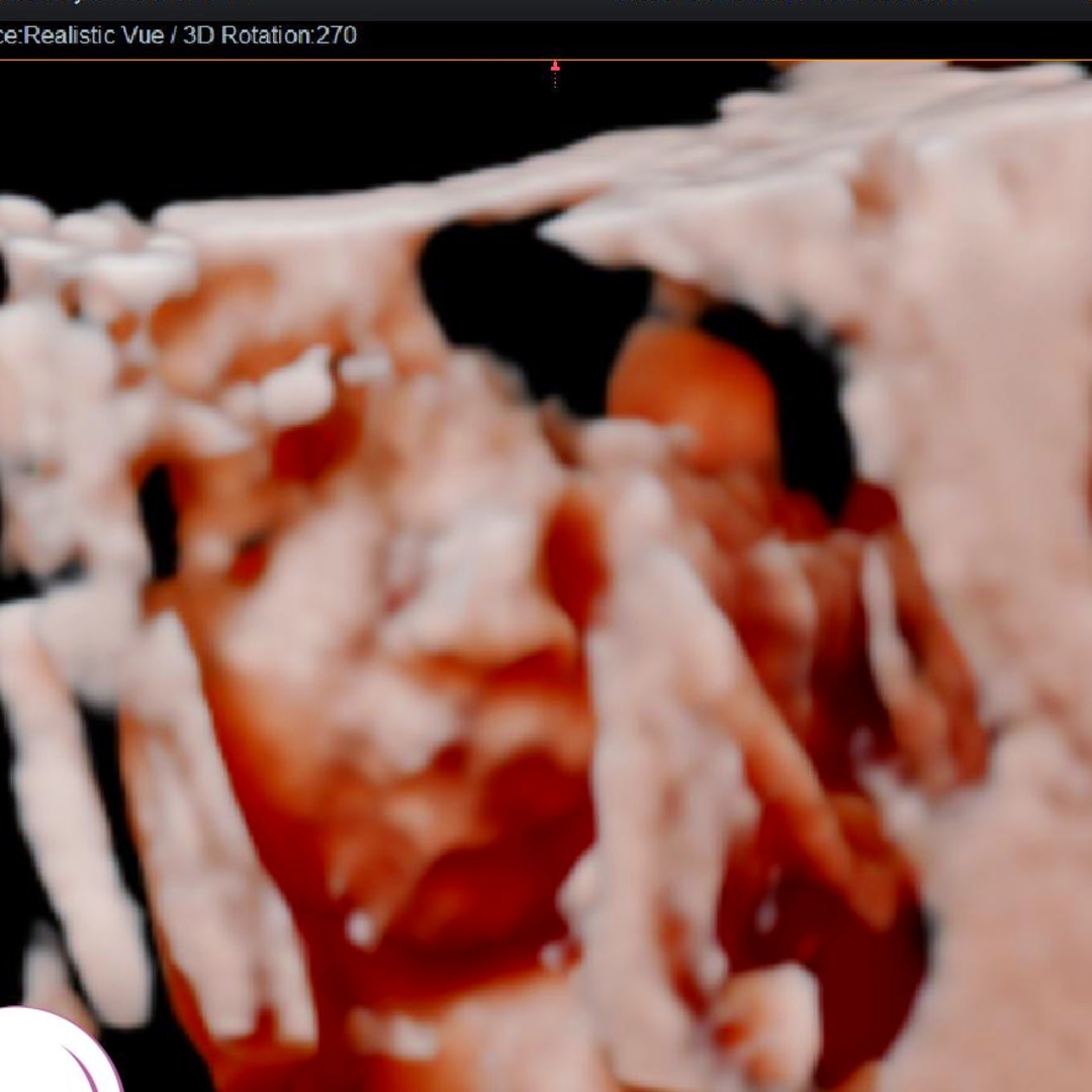 Photo shared by Janelle for their Babylist baby registry.