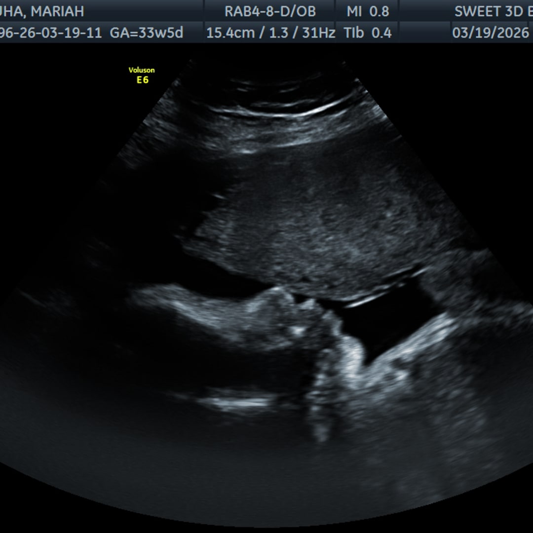 Photo shared by Mariah for their Babylist baby registry.